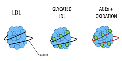 versuikerd LDL